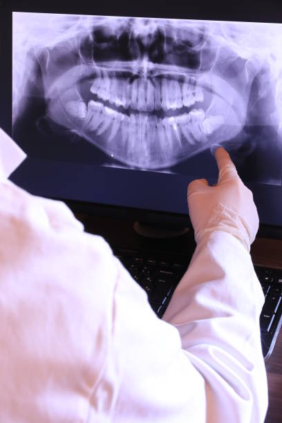 Best Emergency Dental Care for Abscessed Tooth in North Wilkesboro, NC