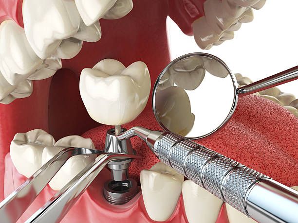 Best Mobile Emergency Dentist in North Wilkesboro, NC